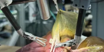 Robô com IA faz cirurgia humana sozinho pela primeira vez