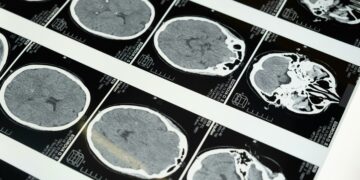 Descubra se sua mente está envelhecendo mais rápido que seu corpo