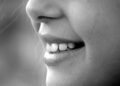Dentista revela melhor técnica caseira para dentes mais brancos