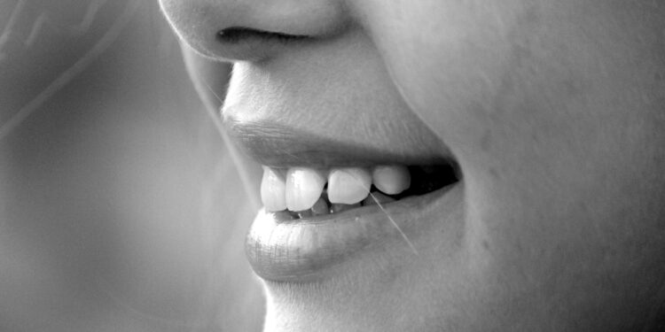 Dentista revela melhor técnica caseira para dentes mais brancos