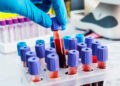 Estudo revela como o sangue pode retardar o envelhecimento
