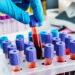 Estudo revela como o sangue pode retardar o envelhecimento