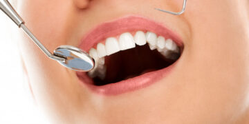 Dentes limpos para sempre: a receita que dermatologistas e dentistas não contam