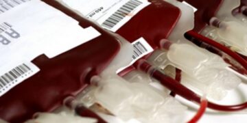 Maneiras fáceis de descobrir seu tipo sanguíneo se você não sabe qual é