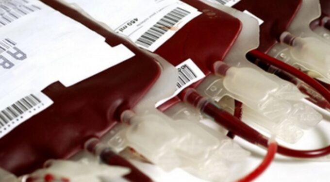 Maneiras fáceis de descobrir seu tipo sanguíneo se você não sabe qual é