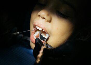 Excesso deste alimento pode prejudicar sua saúde bucal: não são os doces