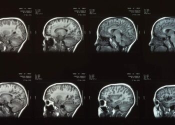 Cientistas encontraram um “interruptor” no cérebro que pode desligar a dor