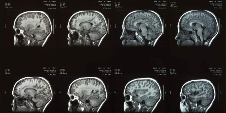 Cientistas encontraram um “interruptor” no cérebro que pode desligar a dor