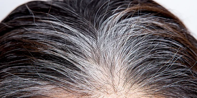 - Adeus cabelos brancos: o método natural para tingir o cabelo e fortalecê-lo