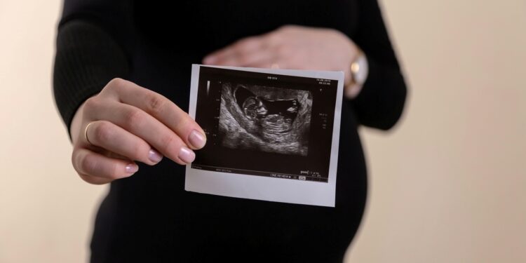 Foto: Volodymyr Hryshchenko/Unsplash