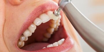 Dentistas quebram o mito: saiba a frequência correta para limpeza bucal