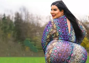 Modelo de 29 anos gastou R$ 800 mil para ter "o maior bumbum do mundo"