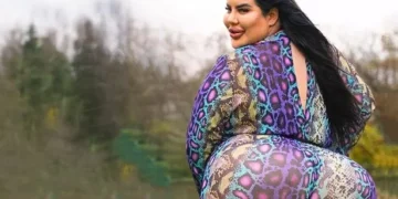 Modelo de 29 anos gastou R$ 800 mil para ter "o maior bumbum do mundo"