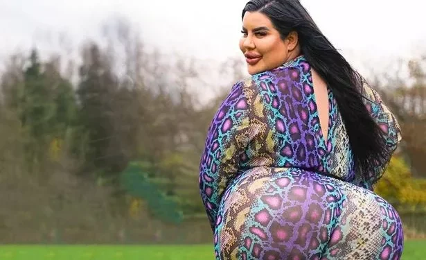 Modelo de 29 anos gastou R$ 800 mil para ter "o maior bumbum do mundo"
