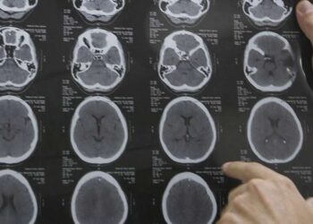 Cientistas chocam o mundo ao revelar que o colesterol pode ser o "herói" do seu cérebro