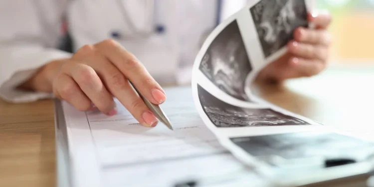 Nova tecnologia supera médicos e identifica câncer com precisão impressionante