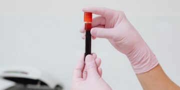 Se seu exame de sangue detectar isso, corra imediatamente até um médico