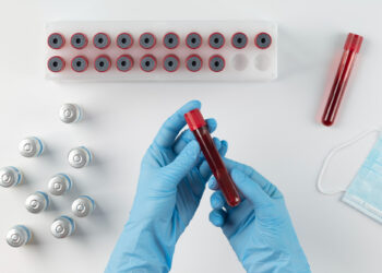 - Sangue ultrarraro conhecido como “dourado” existe em apenas 50 pessoas no mundo todo