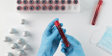 - Sangue ultrarraro conhecido como “dourado” existe em apenas 50 pessoas no mundo todo