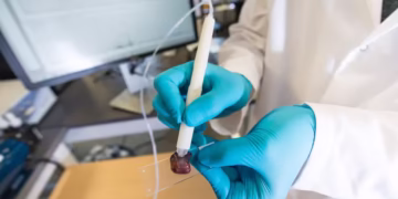 Tecnologia revolucionária de cientista brasileira detecta câncer em apenas 10 segundos