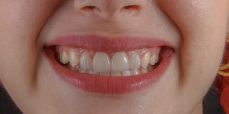 Foto: Ozkan Guner/Unsplash