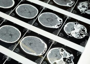 Cientistas diziam ser impossível, mas encontraram um verme capaz de viver no cérebro humano