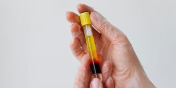 Plasma sanguíneo