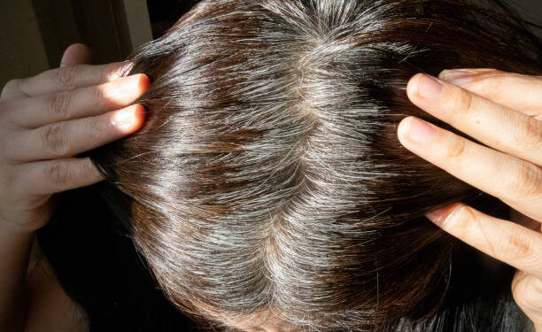 É só idade? Veja o que realmente faz o cabelo ficar branco, segundo a ciência