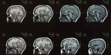 Por volta da metade da gestação, o órgão só tem 10% do volume máximo que alcançará no adulto. Foto: Eduardo Cesar / Revista Pesquisa FAPESP