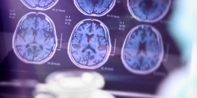 Foto: Divulgação/IgesDF