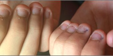 Fonte: Ministério da Saúde