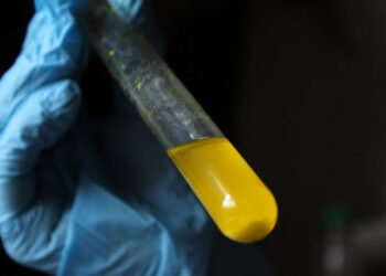 O problema não é apenas a falta 'ádua.

Reprodução: Pexels / Jahra Tasfia Reza