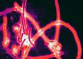Micrografia eletrônica de partículas do vírus Ebola com cores realçadas.

Foto: Thomas W. Geisbert / Wikimedia Commons