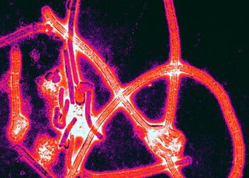 Micrografia eletrônica de partículas do vírus Ebola com cores realçadas.

Foto: Thomas W. Geisbert / Wikimedia Commons