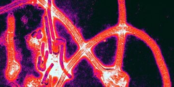 Micrografia eletrônica de partículas do vírus Ebola com cores realçadas.

Foto: Thomas W. Geisbert / Wikimedia Commons