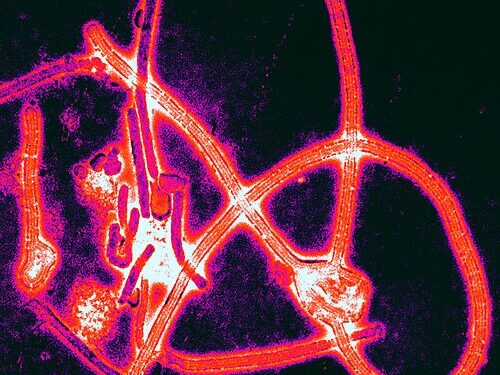 Micrografia eletrônica de partículas do vírus Ebola com cores realçadas.

Foto: Thomas W. Geisbert / Wikimedia Commons