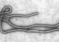 Imagens do vírus da Ebola em microscópio.

Foto: Cynthia Goldsmith / Wikimedia Commons