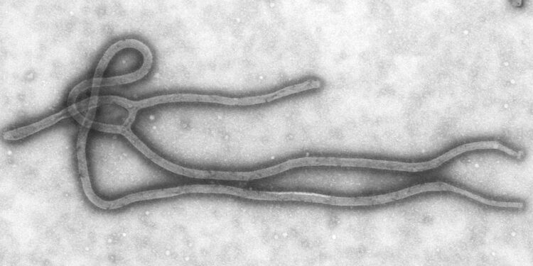 Imagens do vírus da Ebola em microscópio.

Foto: Cynthia Goldsmith / Wikimedia Commons
