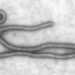 Imagens do vírus da Ebola em microscópio.

Foto: Cynthia Goldsmith / Wikimedia Commons