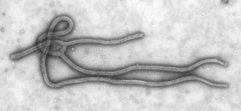 Risco de pandemia no Brasil? Especialistas avaliam possibilidade após alerta da OMS