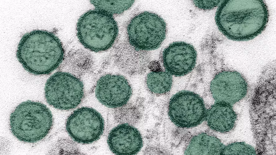 Imagem de passageiro do cruzeiro contaminado por hantavírus na quarentena é divulgada